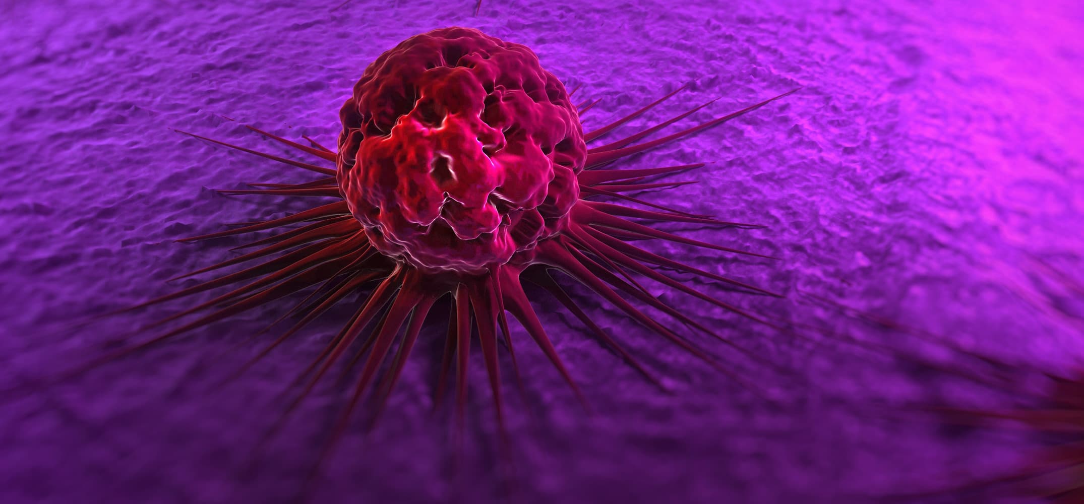 Miért fogynak rohamosan a rákos betegek? - HáziPatika